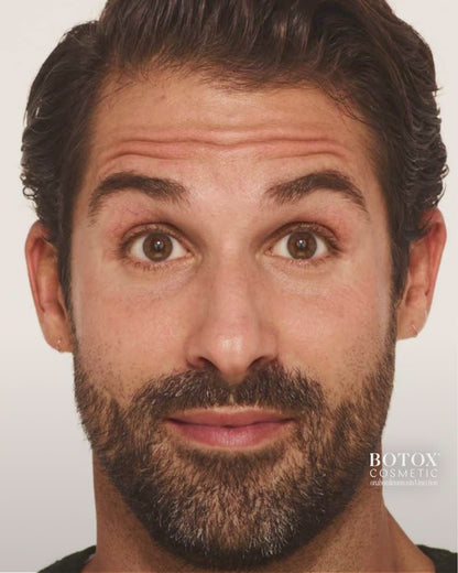 BOTOX® Cosmetic
